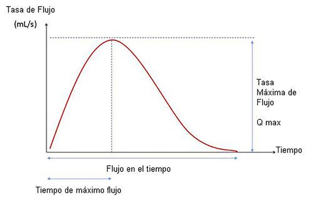 Figura 1. Representación de las variables de la flujometría libre. Qmáx: Pico de flujo durante el vaciado, en ml/sg. Qave: volumen vaciado entre tiempo de micción. Volumen vesical: Volumen vaciado + RPM.