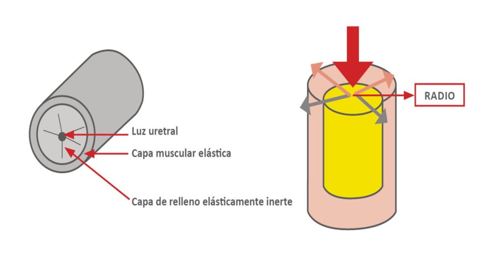 Figura 7. Para abrir la uretra, es necesario aplicar una presión inicial según los principios de la ley de Laplace.